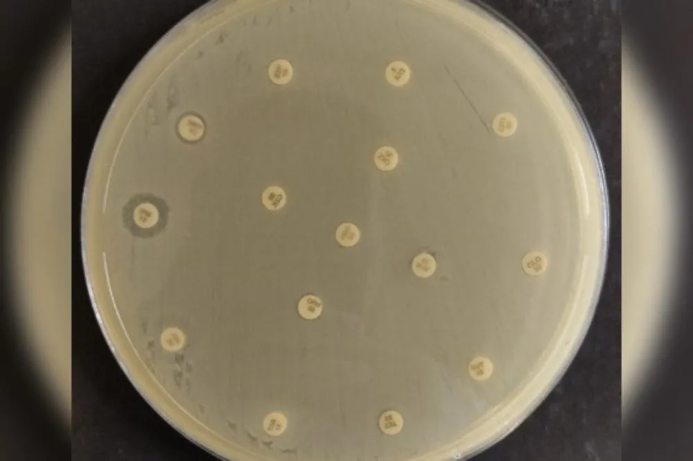 Alerta na saúde: cepa multirresistente de bactéria identificada no Nordeste