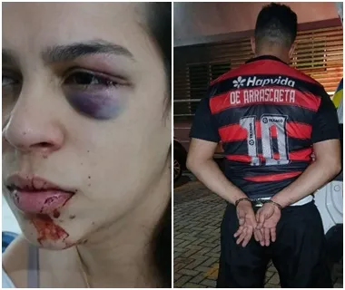 Revogação de prisão em caso de agressão gera alerta da defesa da vítima