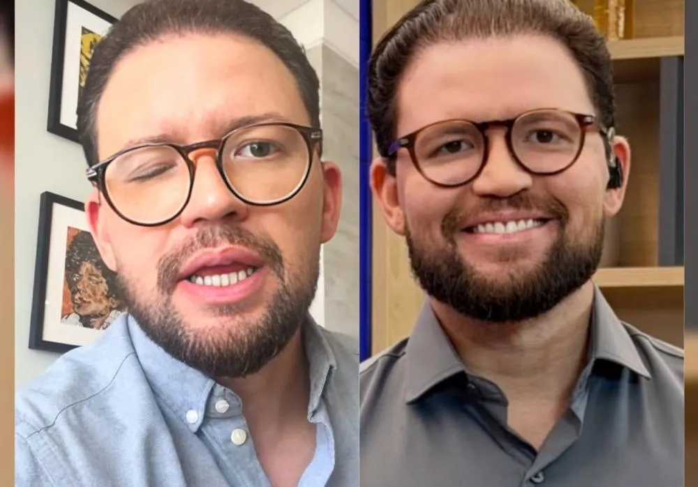 Felipe Pereira encontra-se impossibilitado de abrir um olho - Foto: Reprodução