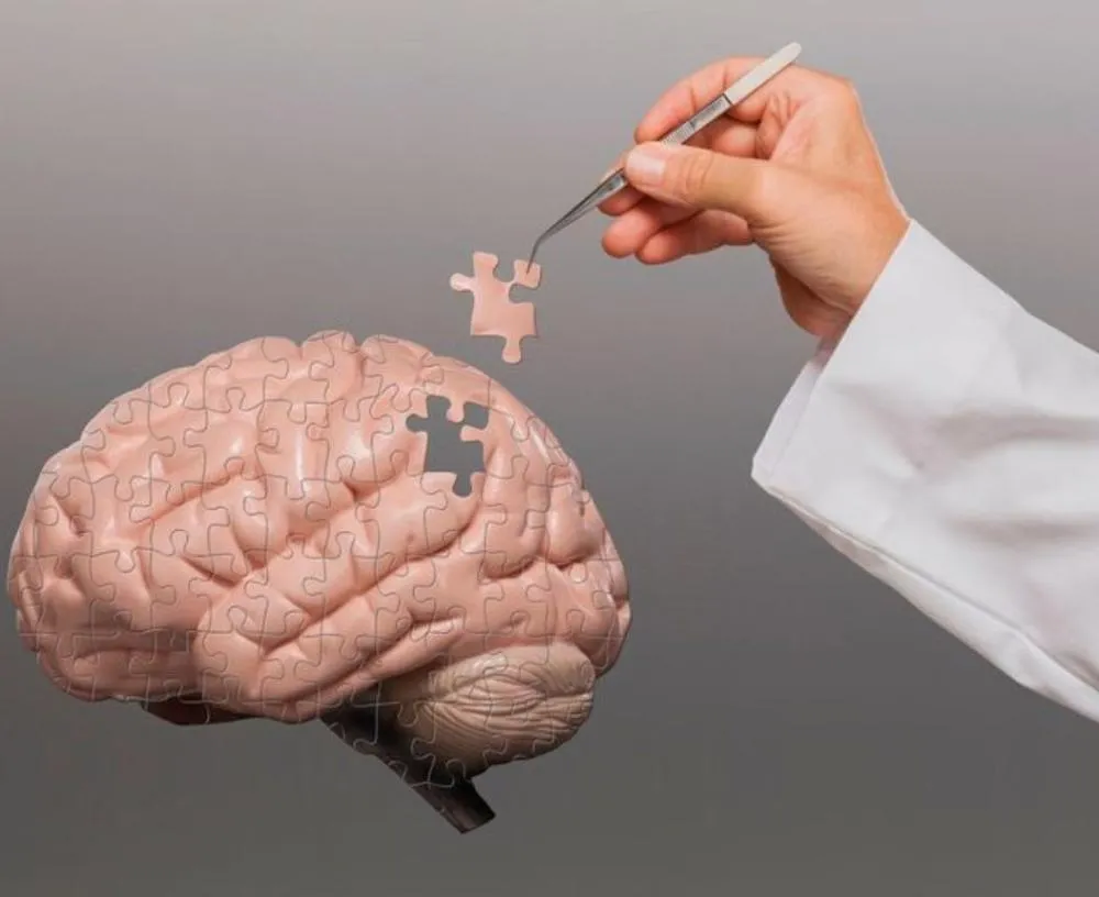 Fora do convencional: Conheça uma abordagem revolucionária no tratamento do Alzheimer