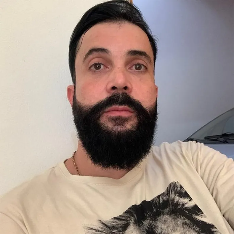 Policial civil baleado na barbearia em Timon passa por cirurgia e sobrevive