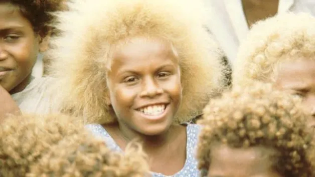 O enigma dos melanésios: negros de cabelos loiros e sua herança genética única
