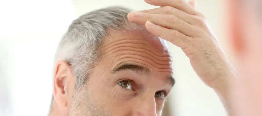 Por que os homens ficam carecas?