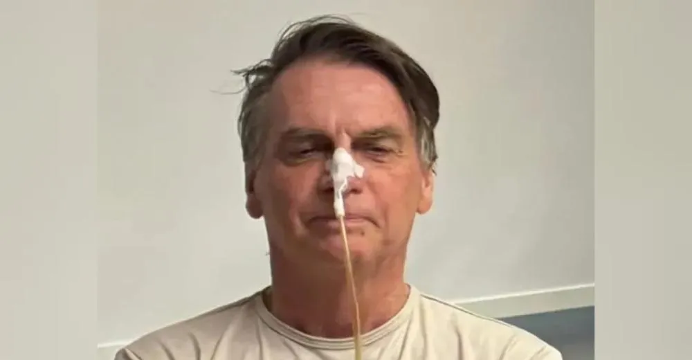 Bolsonaro deixa a UTI após 17 dias de internação por cirurgia abdominal
