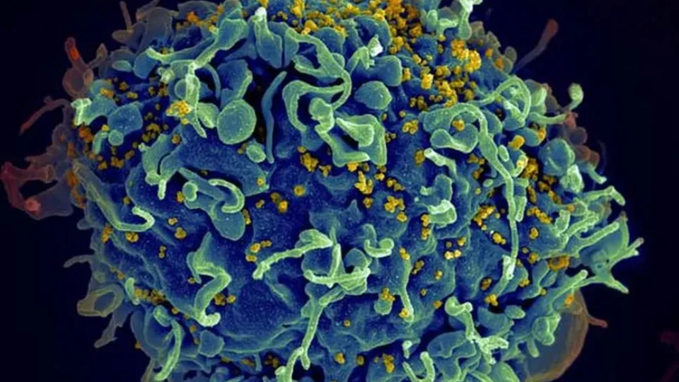 Nova variante do HIV é detectada em três estados no Brasil, alerta pesquisa