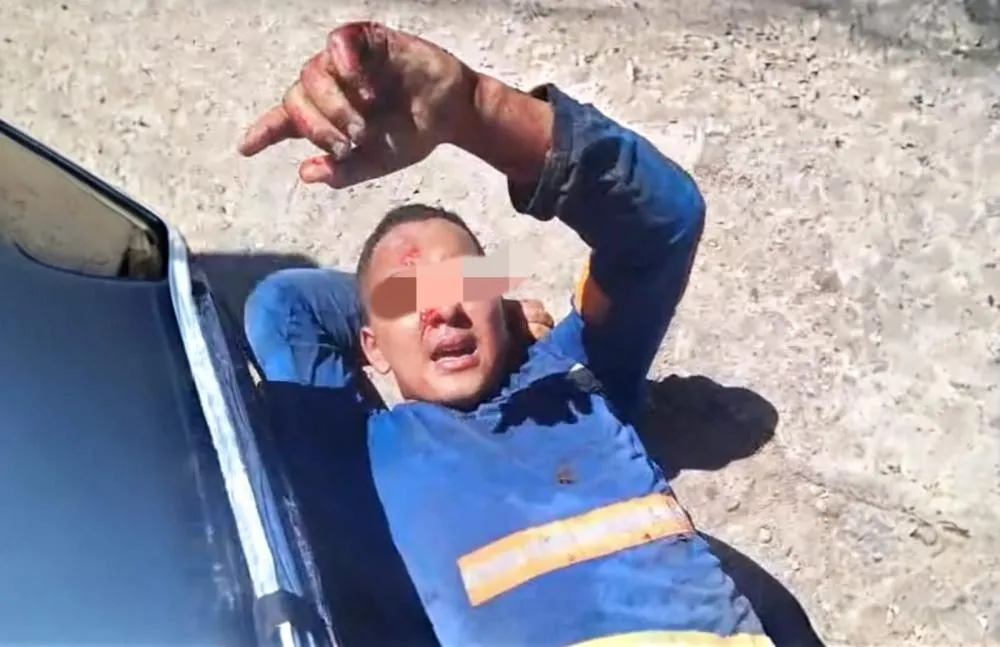 Quando o bandido sangra, a vítima é obrigada a esperar, mesmo ferida
