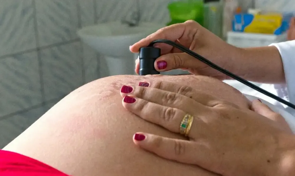 Pré-natal precoce reduz em até 47% o risco de anomalias congênitas, aponta estudo da Fiocruz