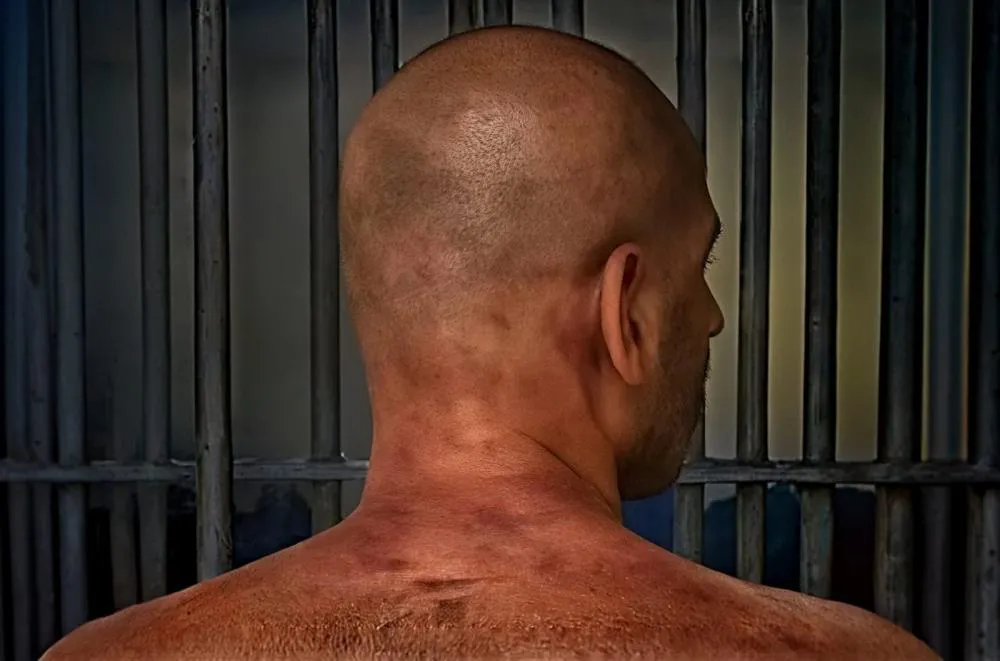 Veja como ficou o corpo do homem que espancou namorada com 61 socos depois que chegou ao presídio