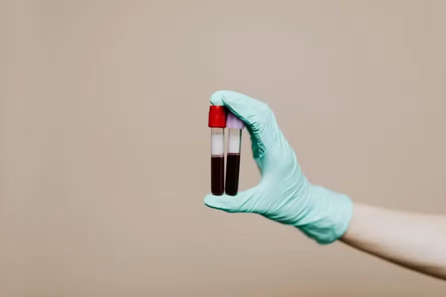 Proteína do sangue jovem pode ser a chave para retardar o envelhecimento