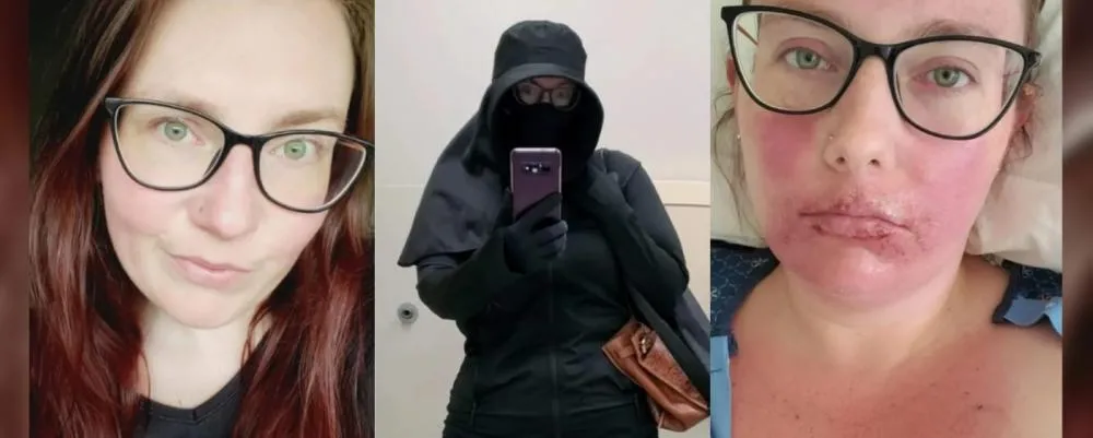 Conheça a mulher 'vampiro' dos tempos modernos