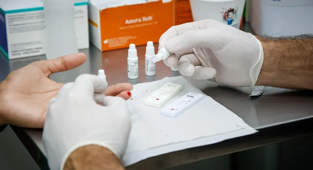 Brasil ainda registra alta de novos casos de HIV e corre contra o tempo para ampliar diagnóstico e prevenção