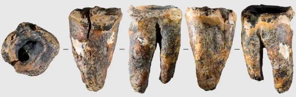 Neandertais faziam “tratamento de canal” há 59 mil anos e desafiam visão moderna sobre a pré-história