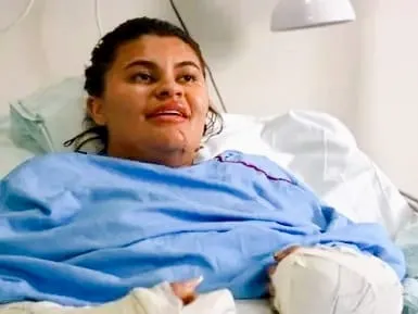 Conheça a triste história de Ana Clara, jovem que teve as mãos decepadas pelo ex