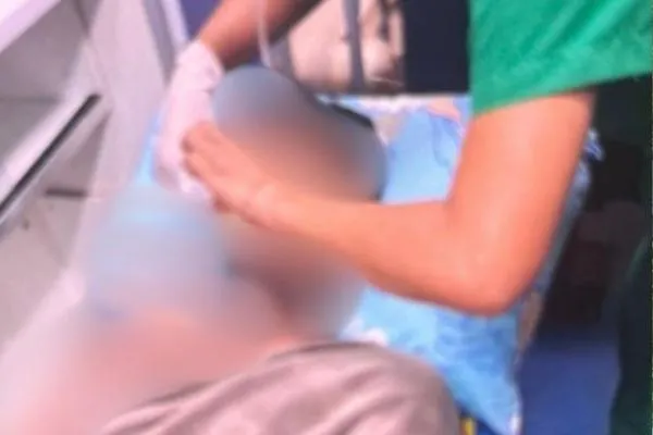Jovem de 21 anos sofre queimaduras após ataque com água quente no Piauí
